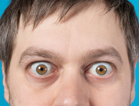 מחלת גרייבס עיניים